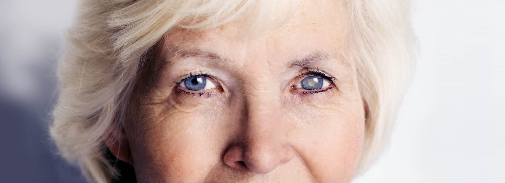 Cataract Surgery in Oak Lawn