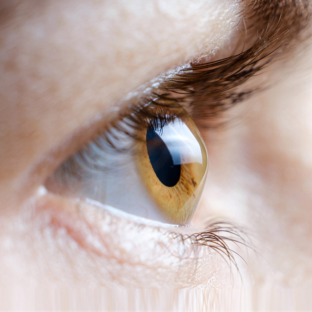 Keratoconus Treatment in Oak Lawn